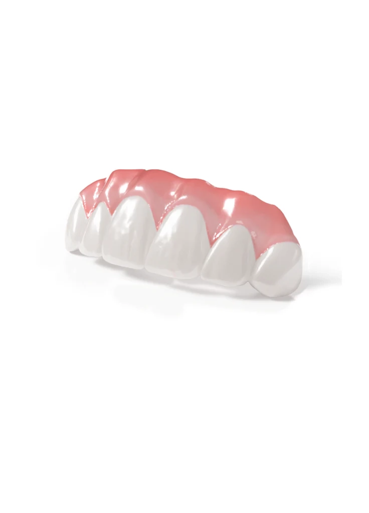 Full Arch Hybrid Shade Sample