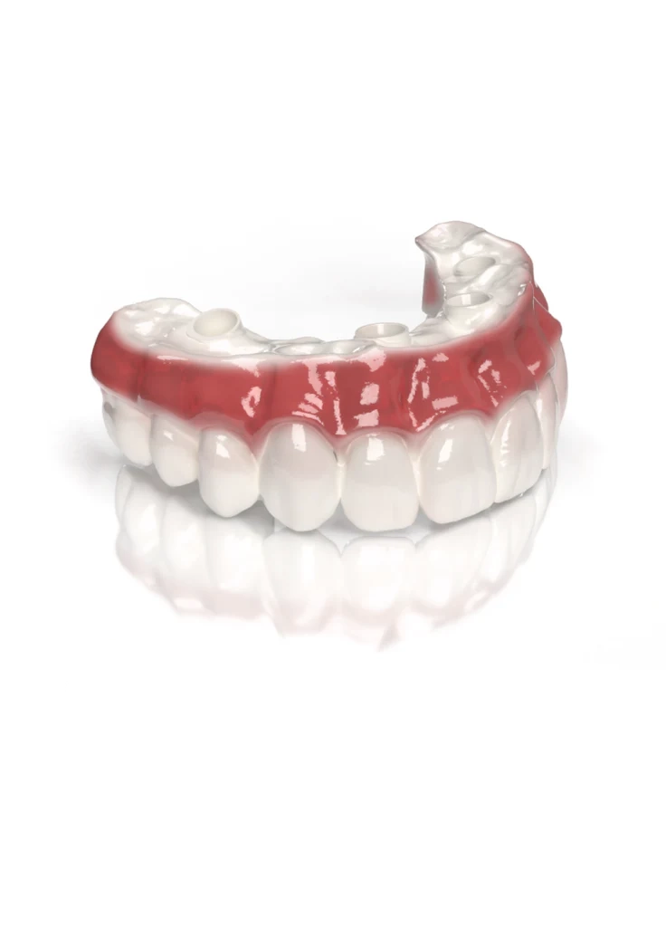 Implant Full Arch Hybrid Zirconia