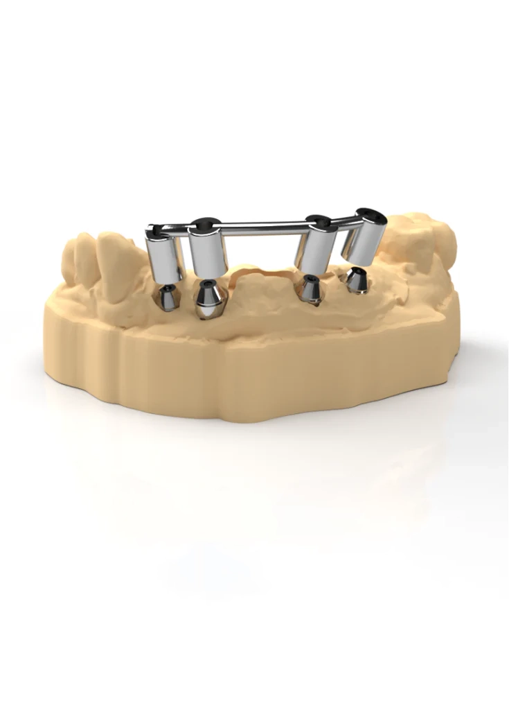 Verification Jig for Full Arch Hybrid